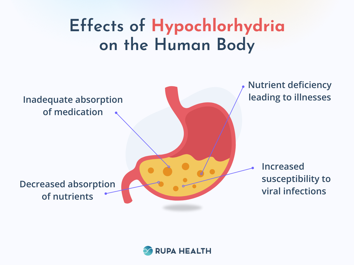Hypochlorhydria (Low Stomach Acid) Symptoms, Diagnosis, & Treatment